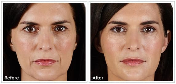 danik-med-spa-vollure2-o5ssirk580tj4pgf0aiee8000750snxttl0ioqv7hw