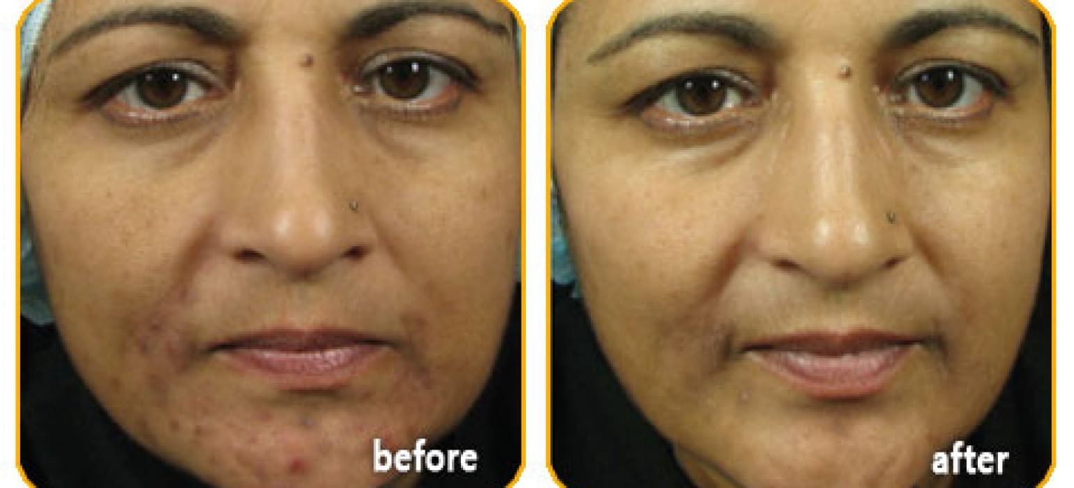 slider-ematrix2-o5sr0dmnkmyuuwnc81bifz2c6l6gc80w32cazid108