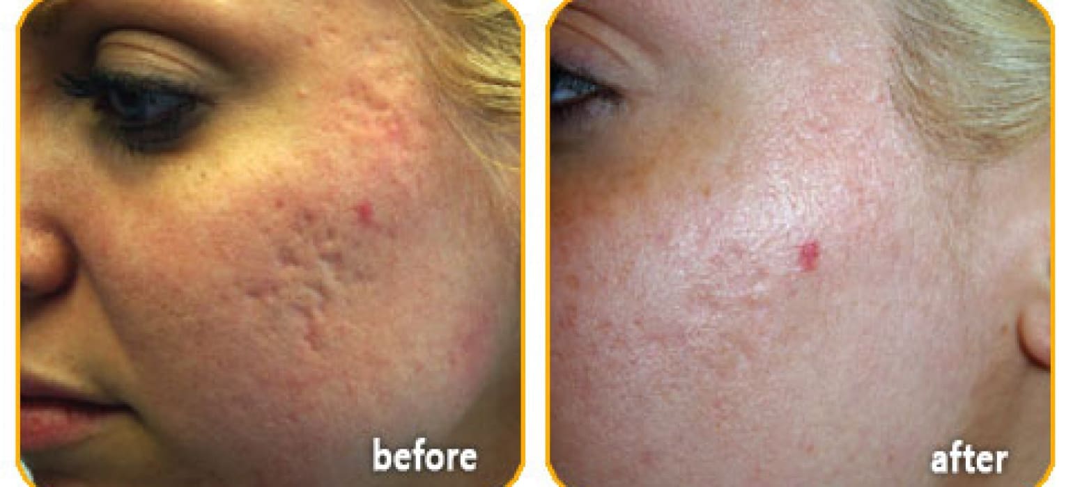 slider-ematrix3-o5sr122gibwb8rnu9bvt8swbmltzwcpwufaxgpcsig