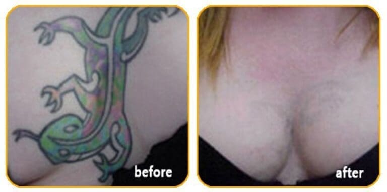 slider-tattoo3-o5srcs3sol0ry9e3bjriq4l840gzu5anp4hebsyqi4