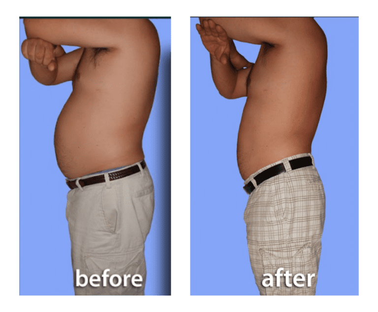 weightloss (1)
