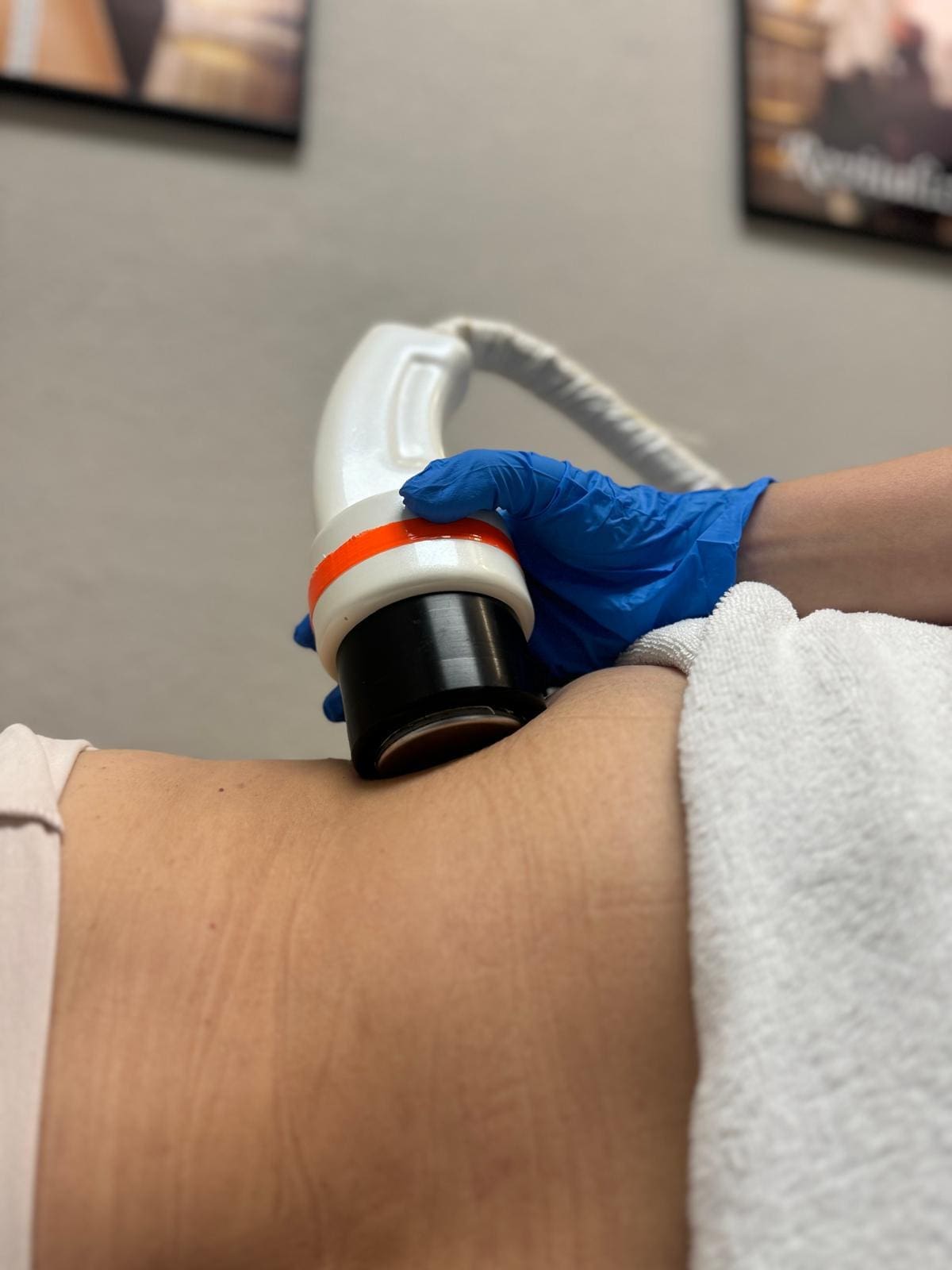 Pacient doing the Ultrasound Cavitation Treatment at Danik Med Spa
