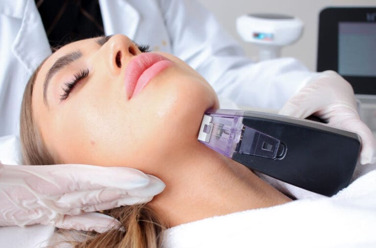 Woman lying down receiving microneedling for morpheus8 facial rejuvention treatment in face and neck at Danik Medspa