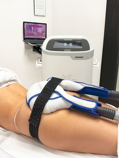 Client receiving CoolTone muscle stimulation treatment for body sculpting.